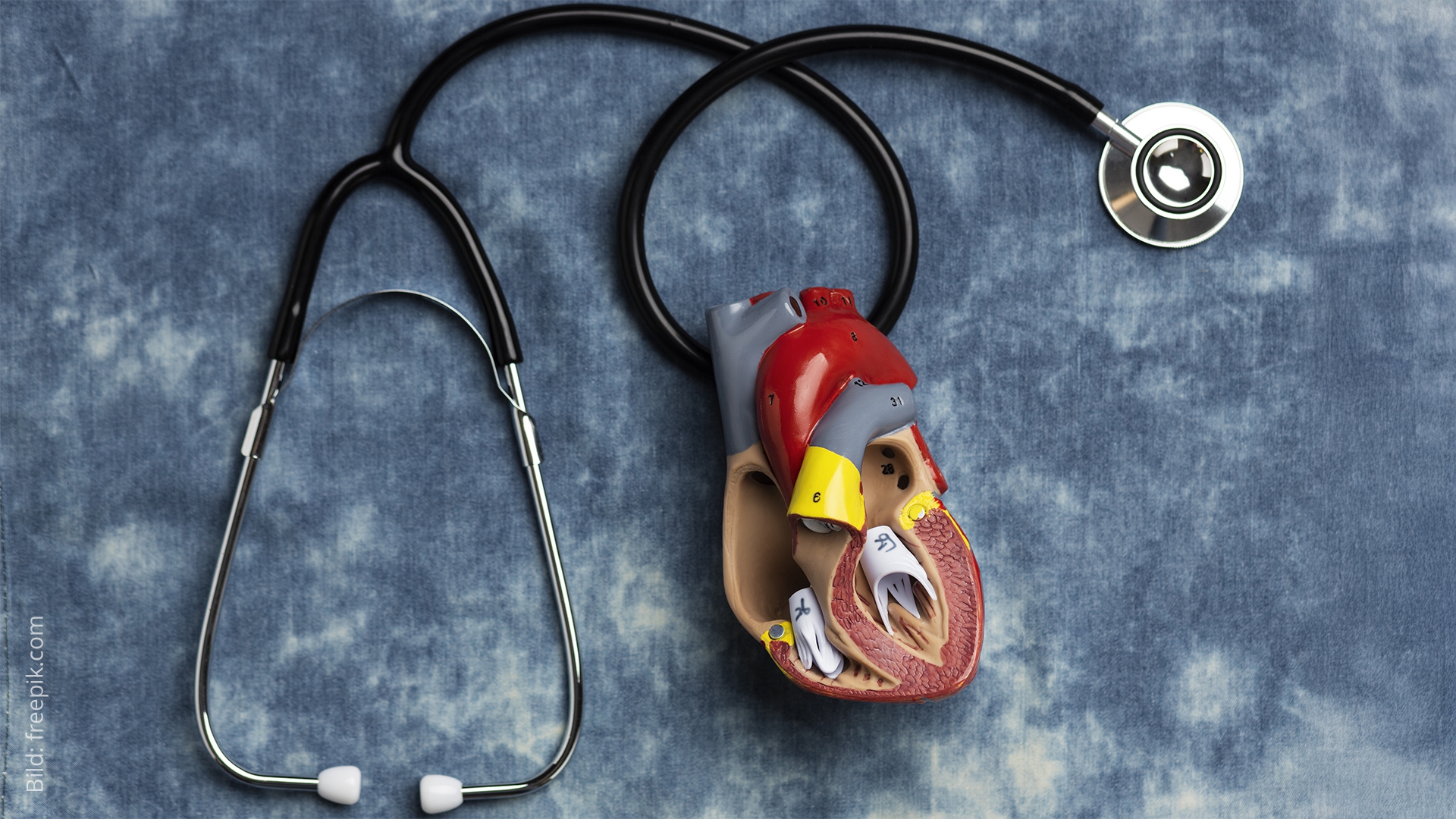 Omega-3-Fettsäuren bei der Herzinsuffizienz